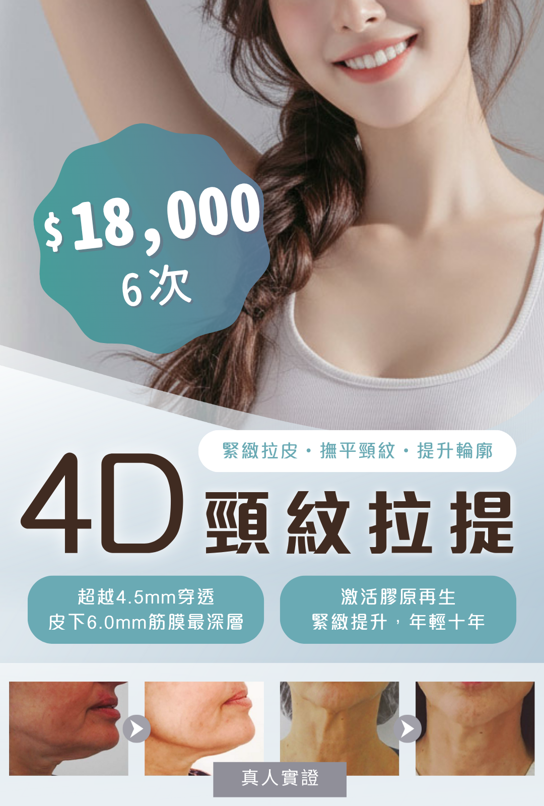 4D 頸紋拉提