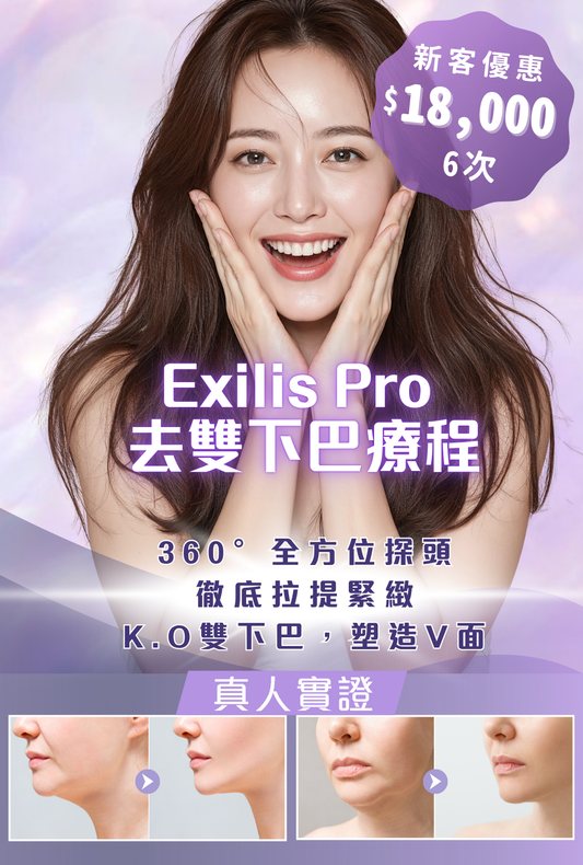 Exilis Pro 去雙下巴療程