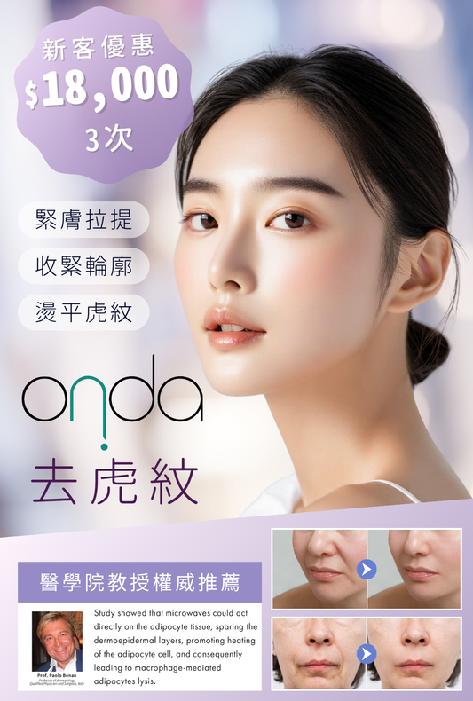 Onda 去虎紋