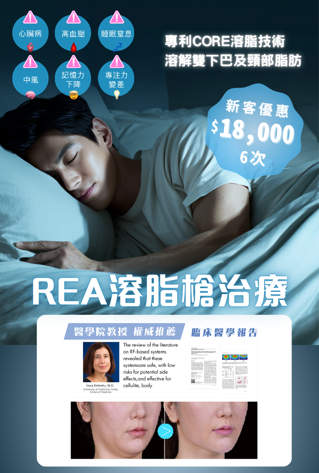 REA溶脂槍治療